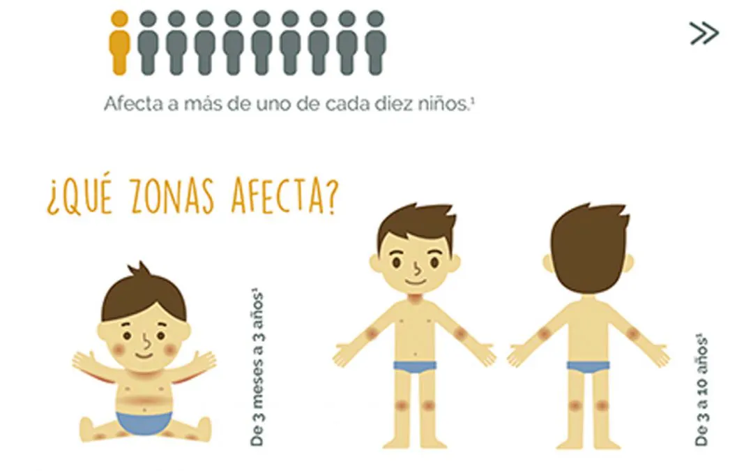 Tarjetón “Dermatitis atópica”